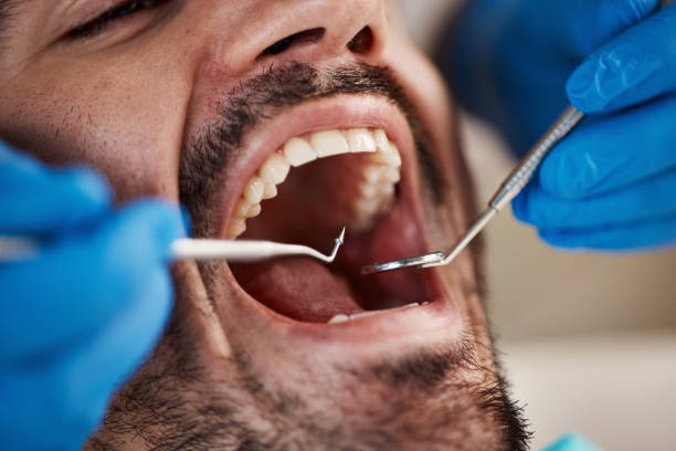 Best Emergency Care for Gum Disease in Rouses Point, NY