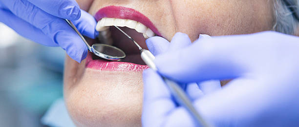 Best Broken or Chipped Tooth Repair in Rouses Point, NY